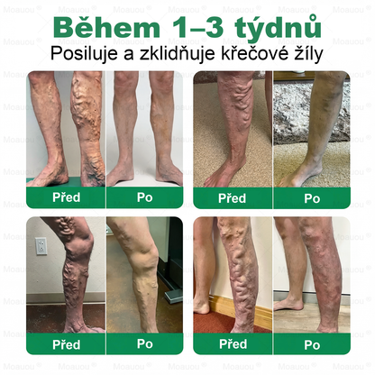 🎁 Zbývá už jen 5 balení! Nabízíme vám dodatečnou slevu 50%! Dostaňte se do formy a buďte zdraví. Zhubněte nyní, jinak už do příštího roku nebudete mít další šanci!
