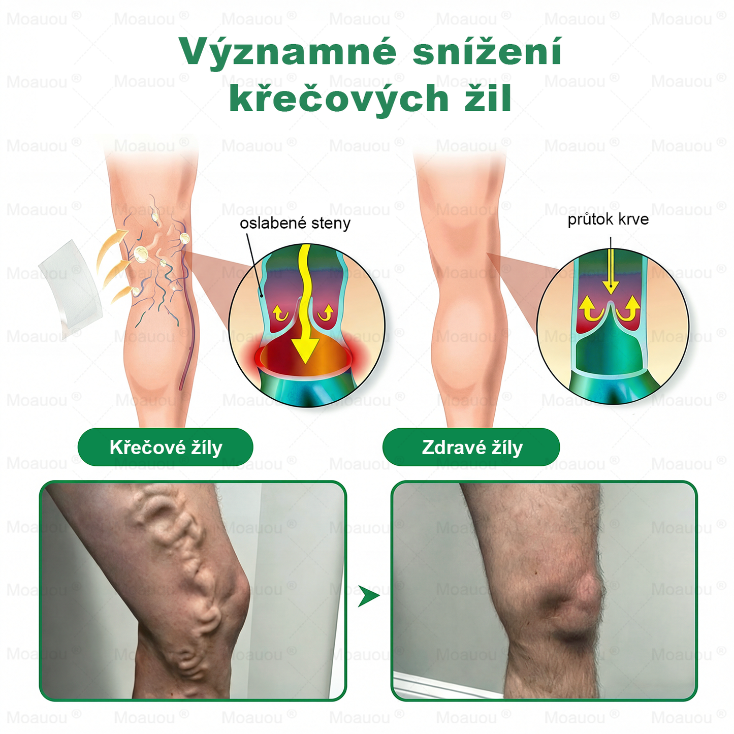 🎁 Zbývá už jen 5 balení! Nabízíme vám dodatečnou slevu 50%! Dostaňte se do formy a buďte zdraví. Zhubněte nyní, jinak už do příštího roku nebudete mít další šanci!